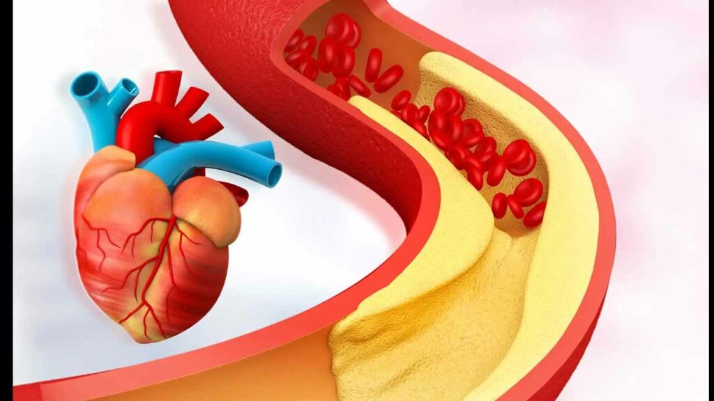 Cholesterol