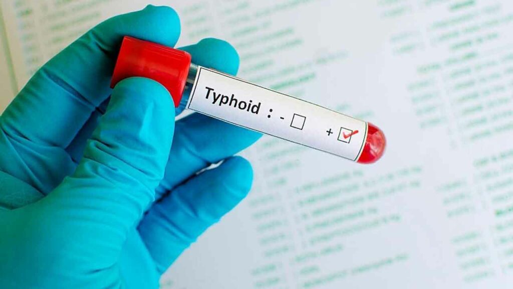 Post Typhoid